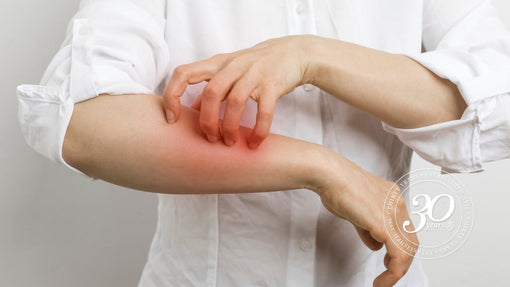 Eczema and Psoriasis: What Does Ayurveda Look at Beyond the Skin?