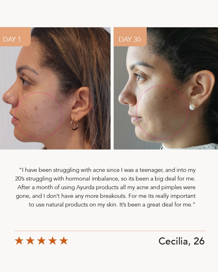 Magic Touch with Manjistha and Turmeric