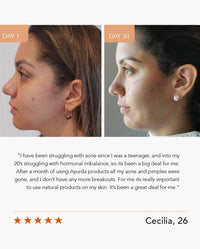 Magic Touch with Manjistha and Turmeric