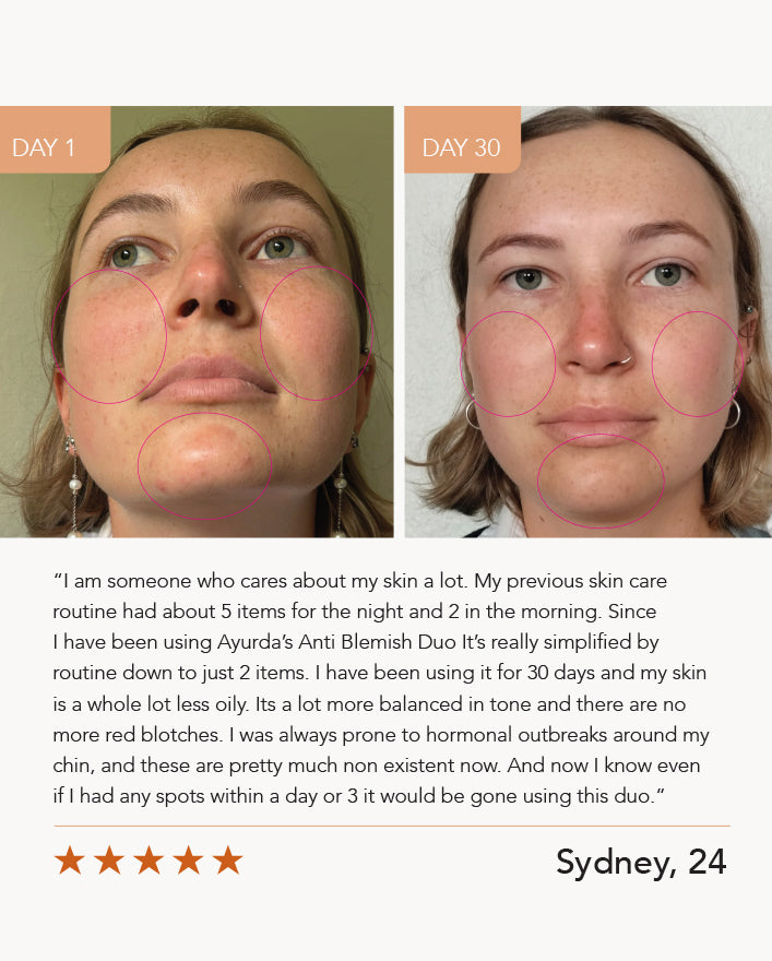 Magic Touch with Manjistha and Turmeric