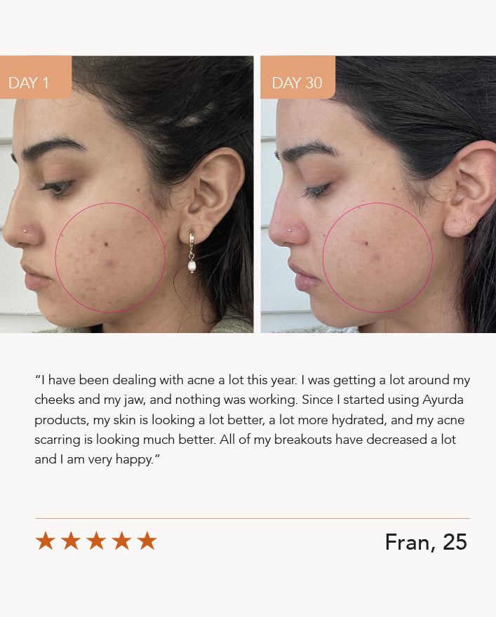 Magic Touch with Manjistha and Turmeric