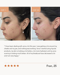 Magic Touch with Manjistha and Turmeric